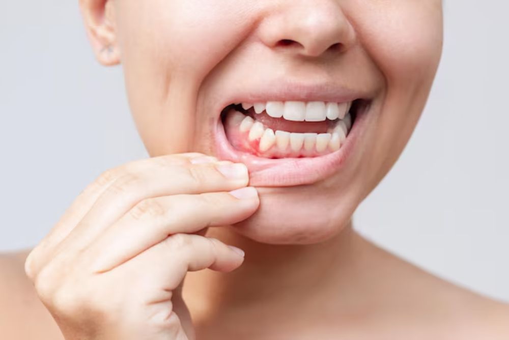 best vitamins for gum health for strong teeth and gums